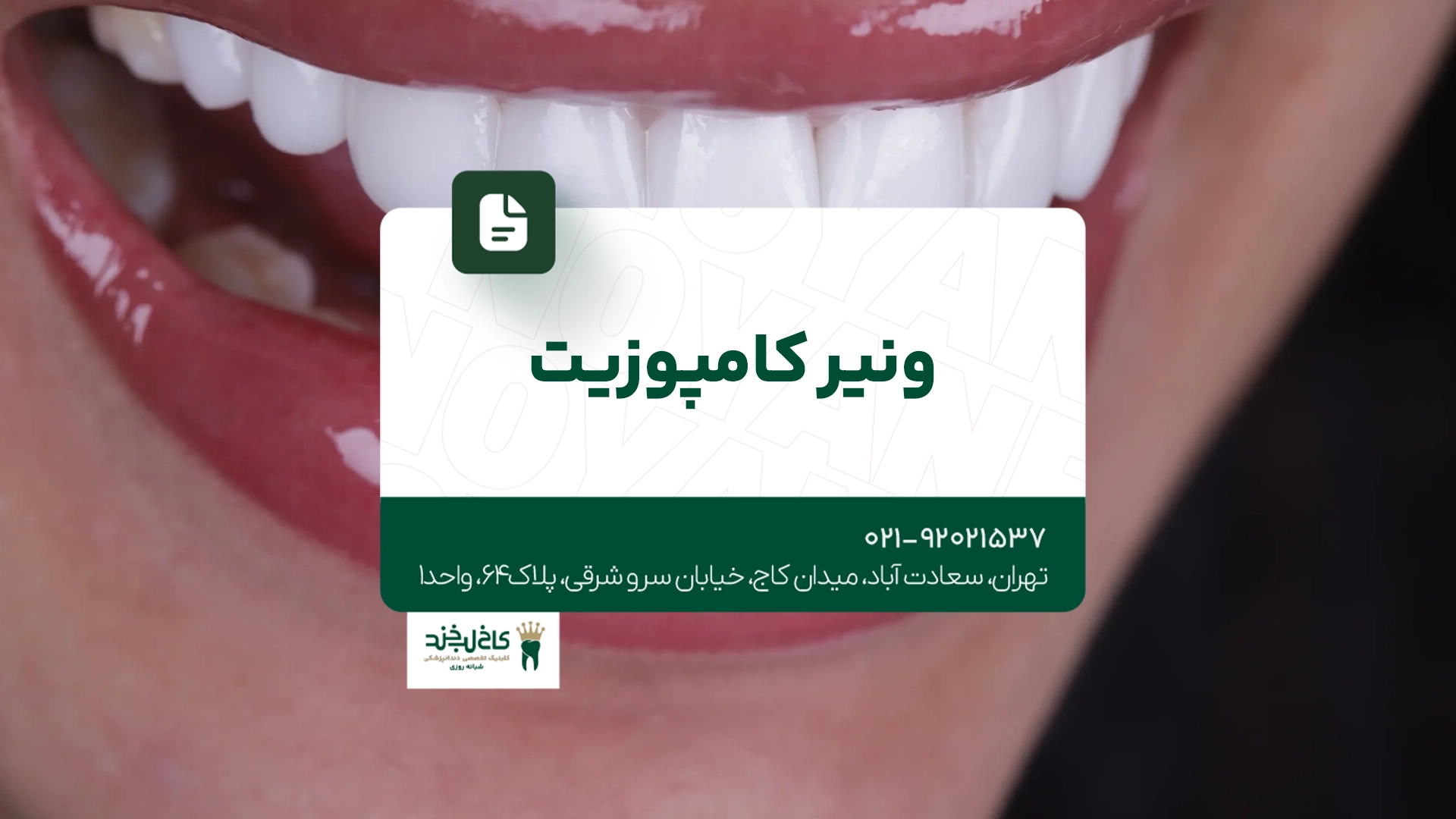 ونیر کامپوزیت