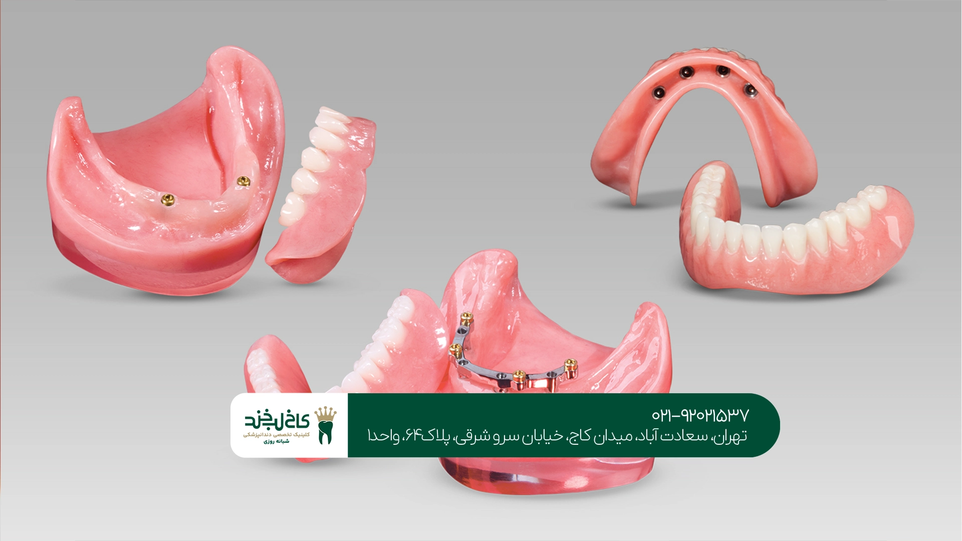 کلینیک مجهز ایمپلنت و پروتز