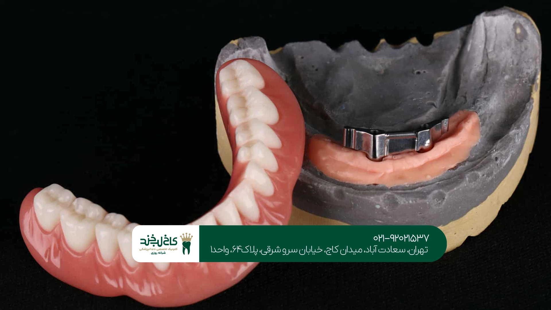 بهترین کلینیک ایمپلنت و پروتز