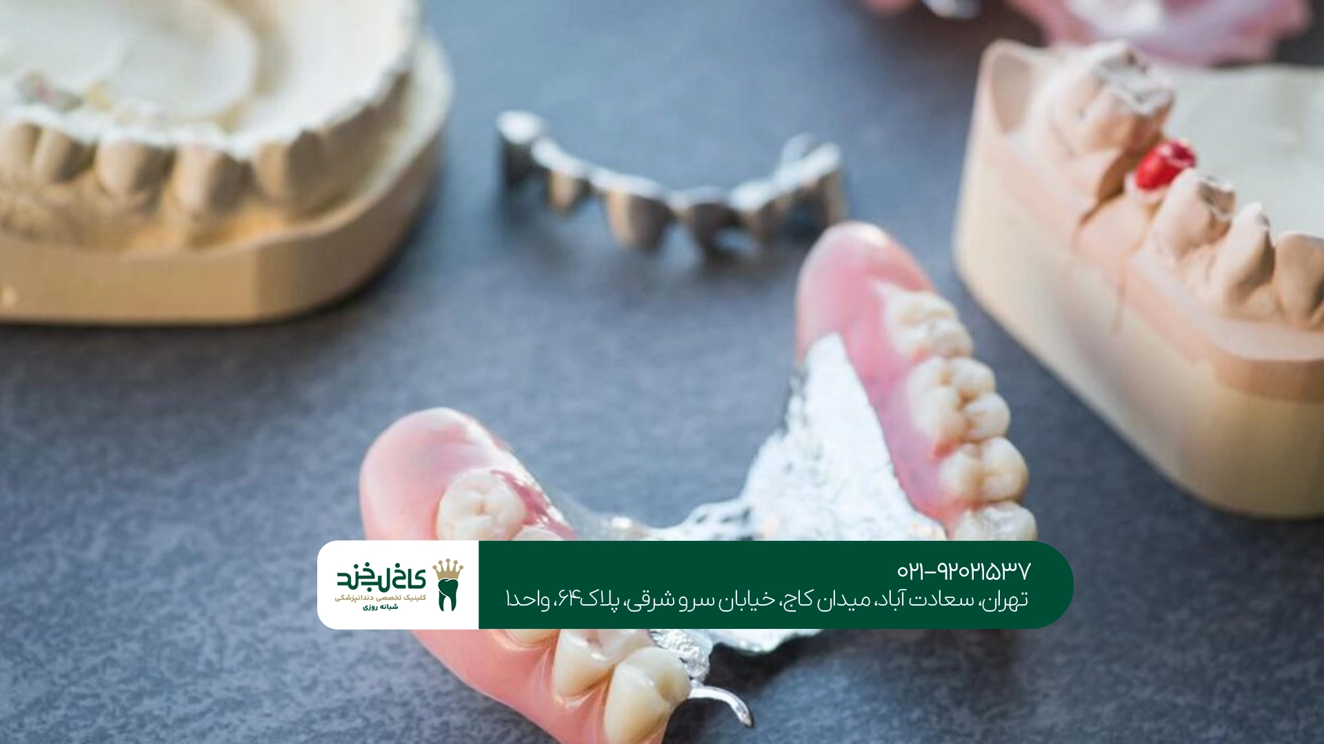 پروتز دندان پروتز دندان