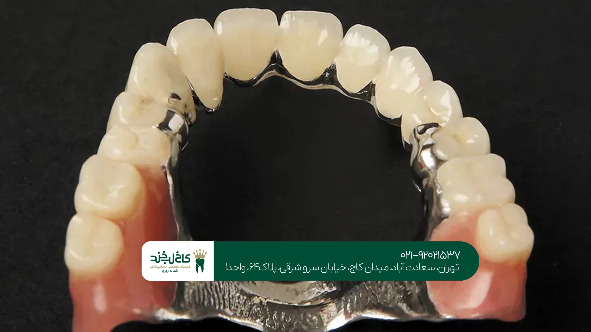 بهترین پروتز دندان در سعادت آباد بهترین پروتز دندان در سعادت آباد