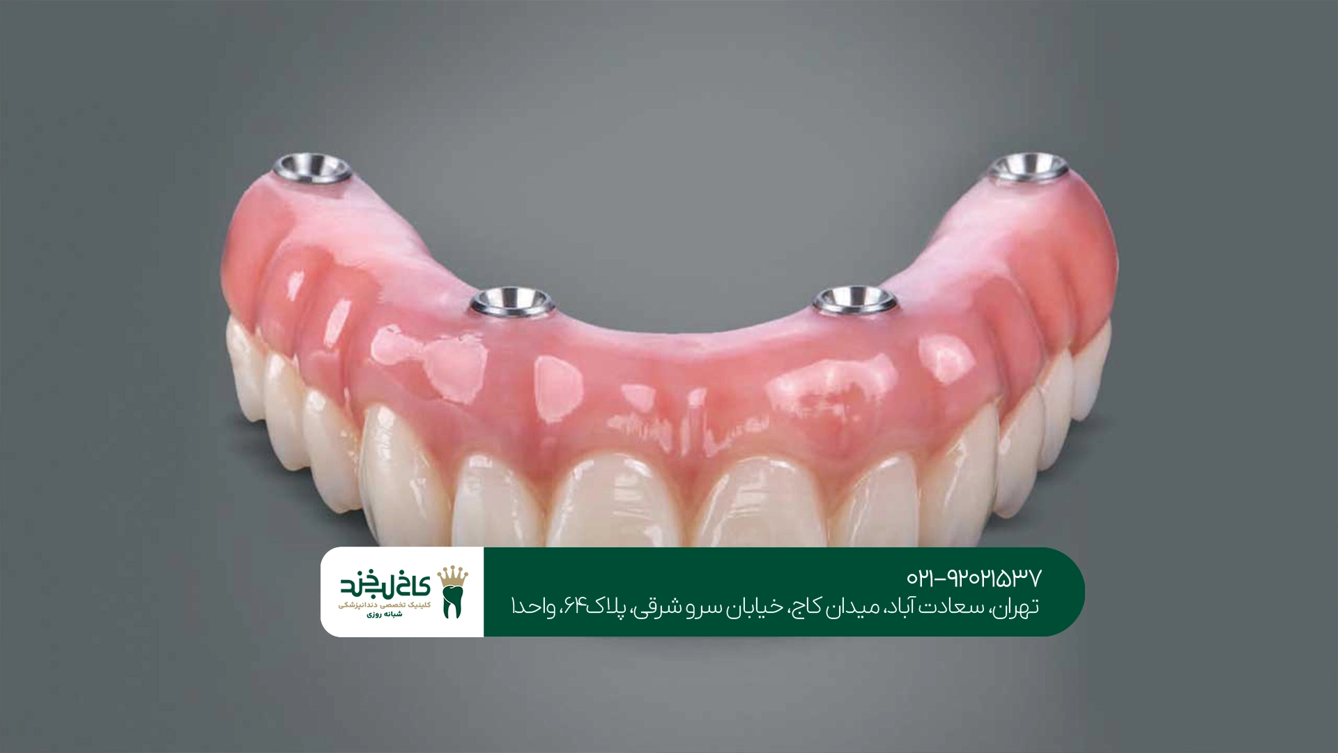 بهترین مرکز پروتز دندان تهران بهترین مرکز پروتز دندان تهران