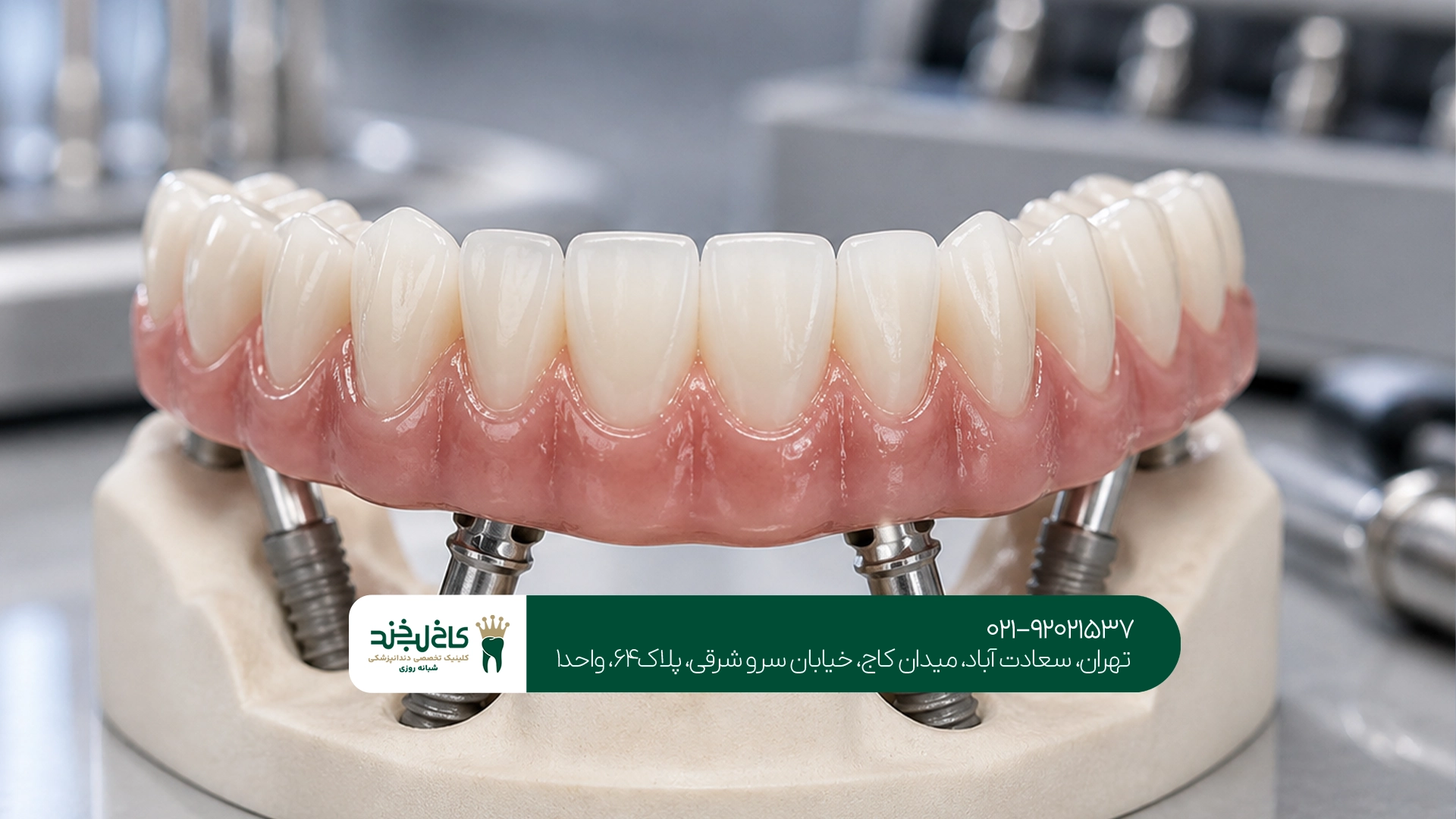 پروتز دیجیتال چگونه ساخته میشود؟
