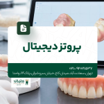 پروتز دیجیتال
