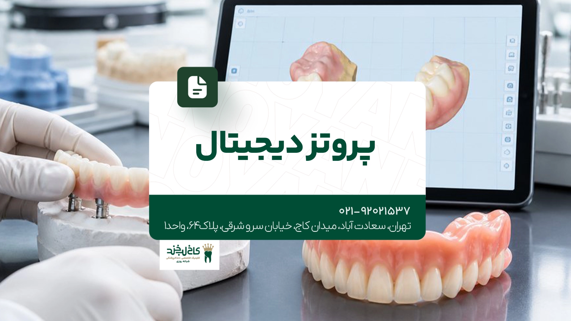 پروتز دیجیتال