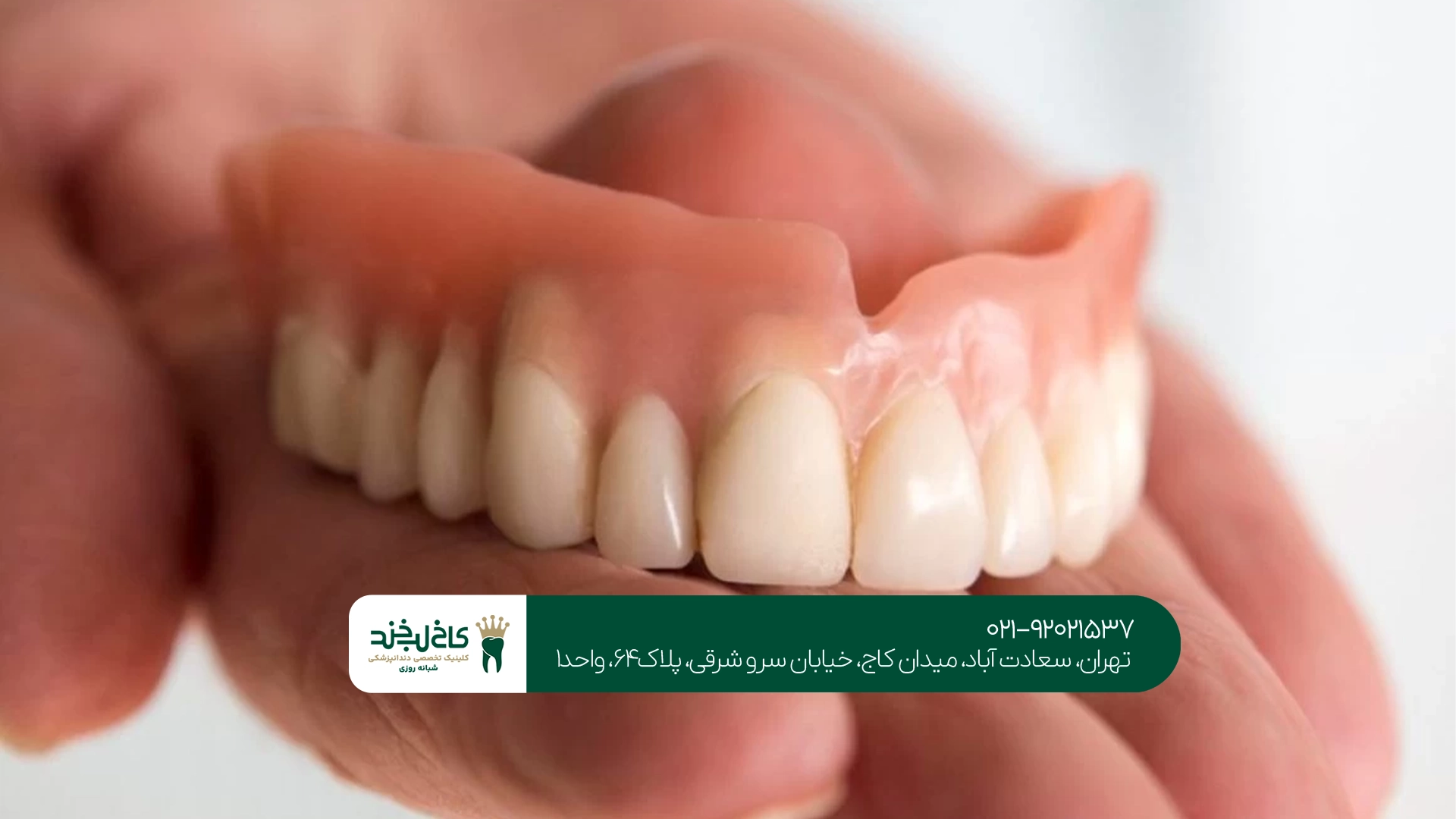 مراحل ساخت پروتز کامل فک چگونه انجام میشود؟
