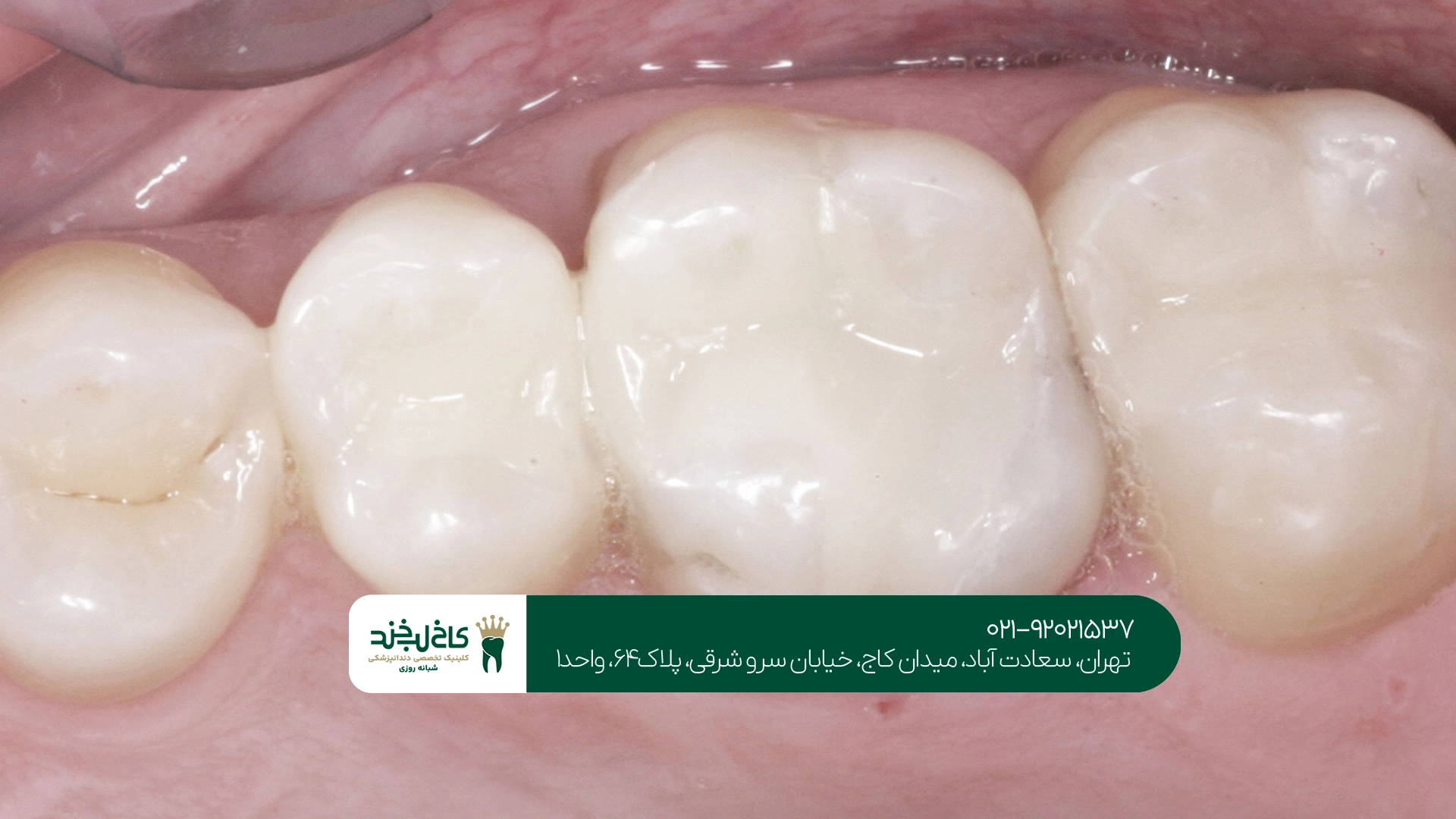 بهترین کلینیک ترمیم دندان تهران بهترین کلینیک ترمیم دندان تهران