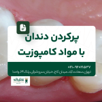 پر کردن دندان با کامپوزیت
