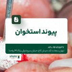 پیوند استخوان
