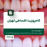 کامپوزیت اقساطی تهران