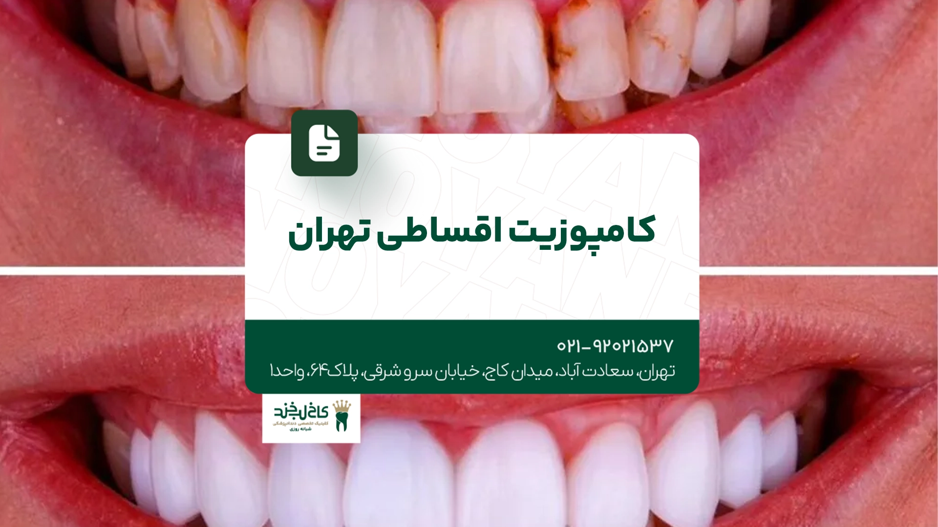 کامپوزیت اقساطی تهران