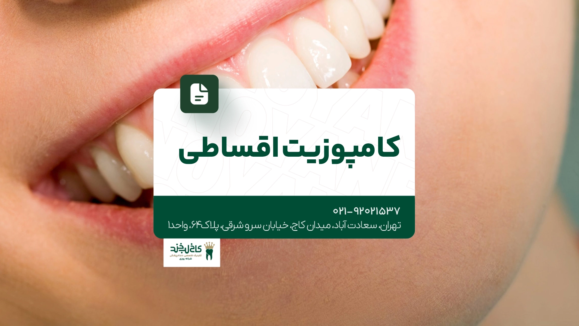 کامپوزیت اقساطی