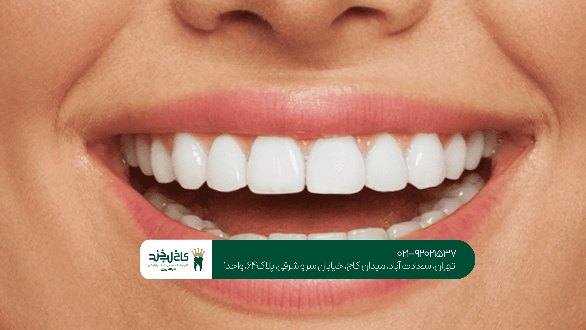 کلینیک کامپوزیت اقساطی تهران