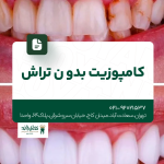 کامپوزیت بدون تراش