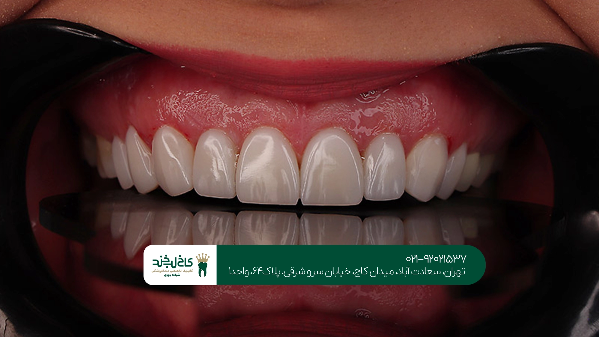 قیمت کامپوزیت سارمکو