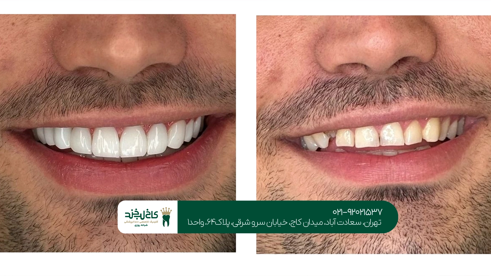 کامپوزیت سارمکو در تهران