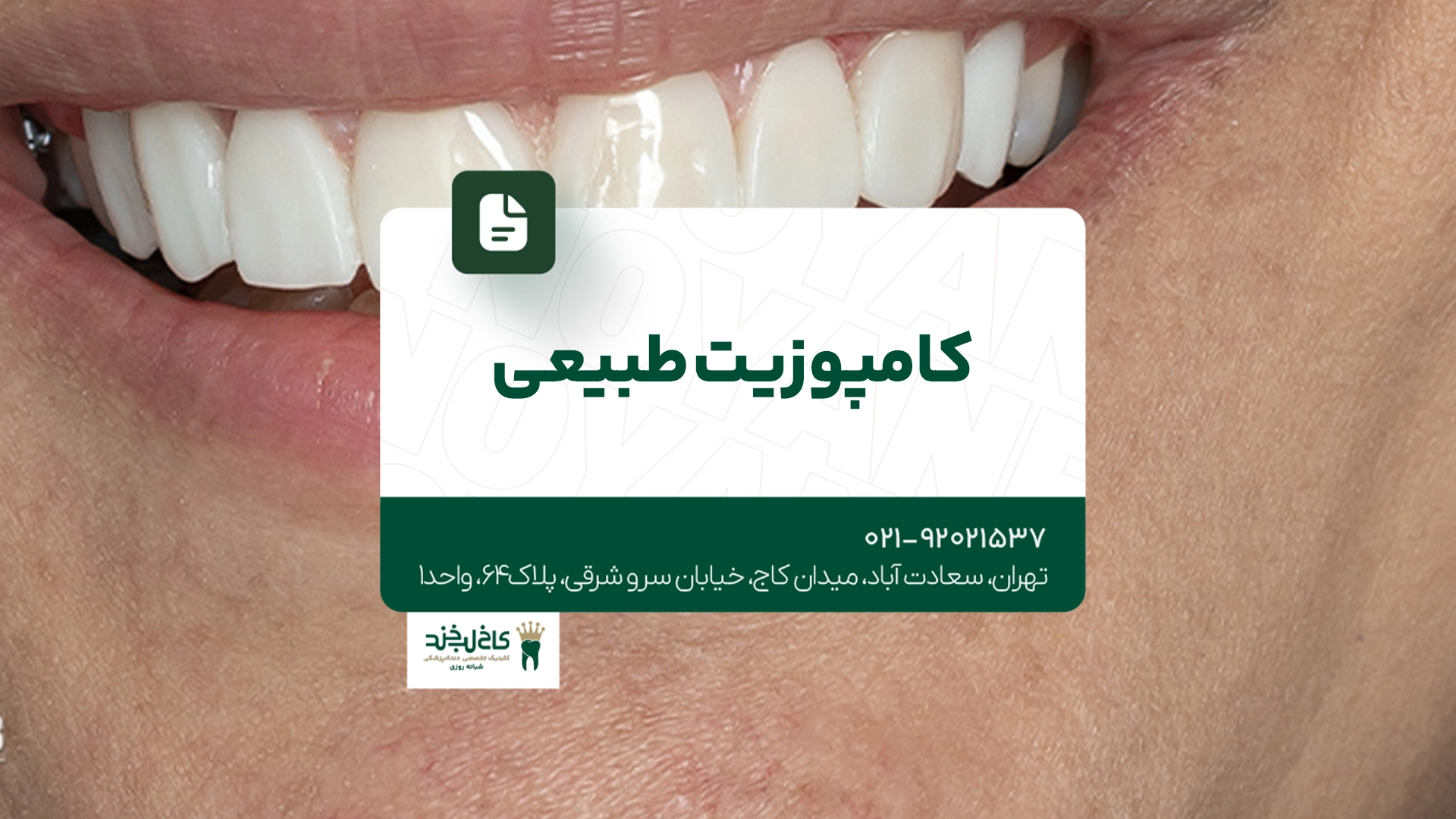 کامپوزیت طبیعی کامپوزیت طبیعی