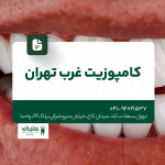 کامپوزیت غرب تهران