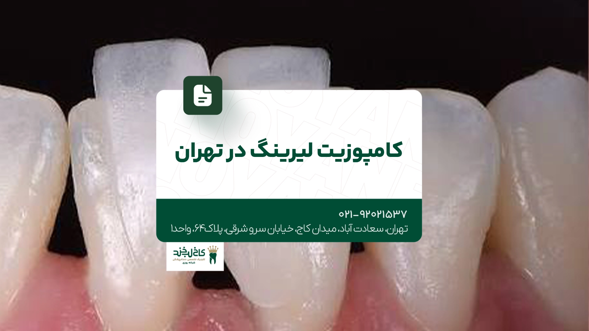 کامپوزیت لیرینگ در تهران کامپوزیت لیرینگ در تهران