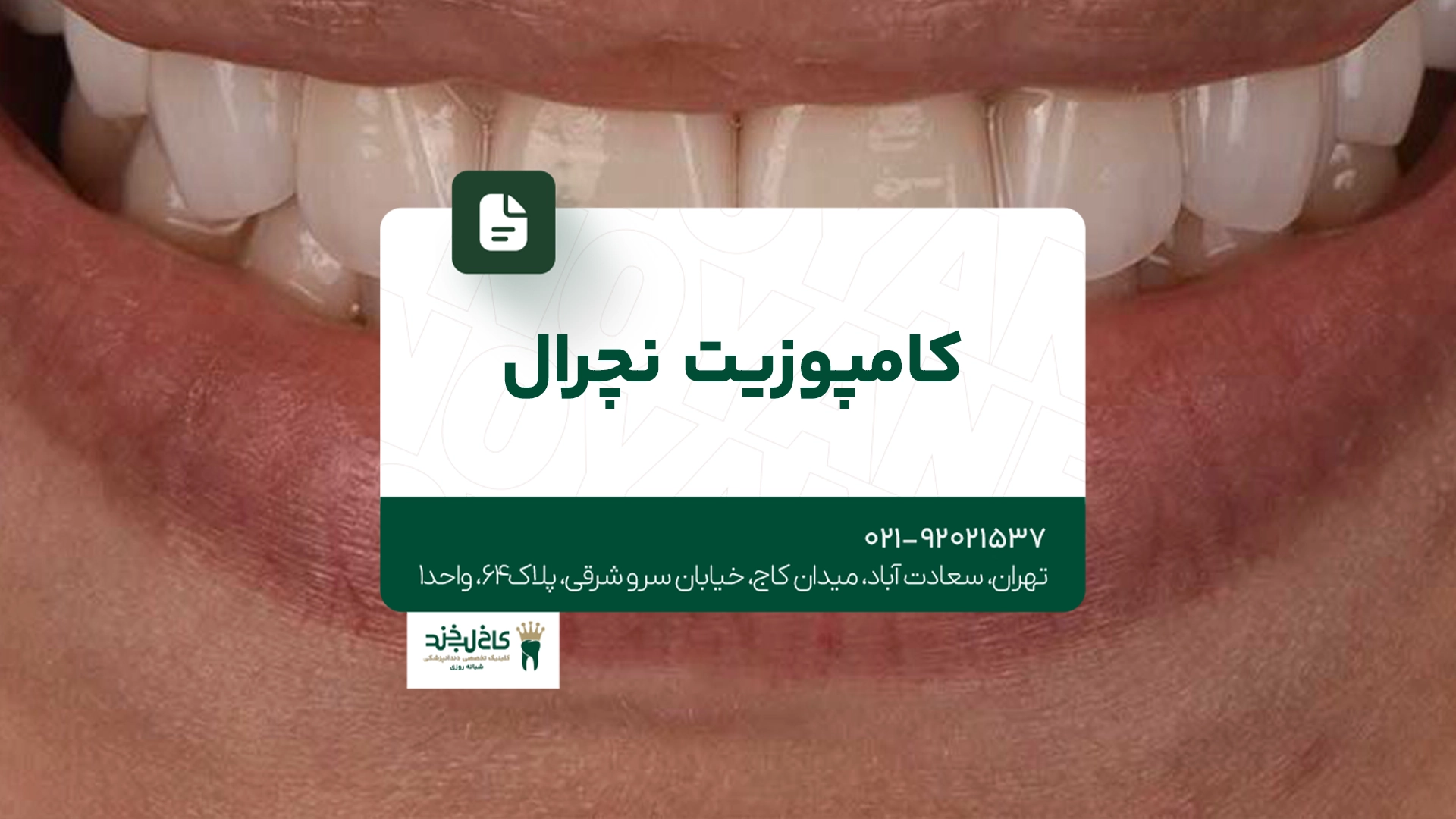 کامپوزیت نچرال کامپوزیت نچرال