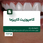 کامپوزیت کاریزما