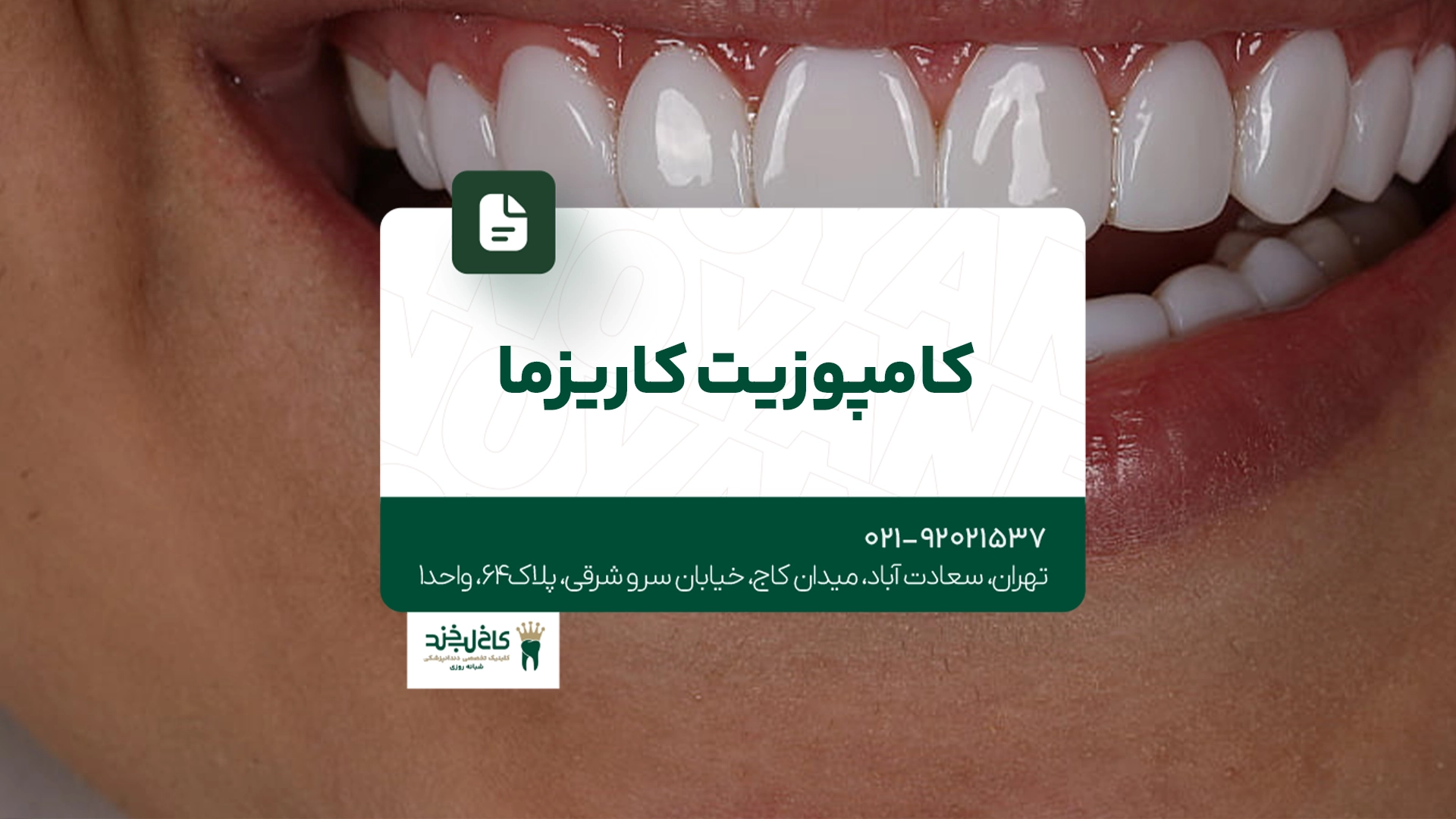 کامپوزیت کاریزما