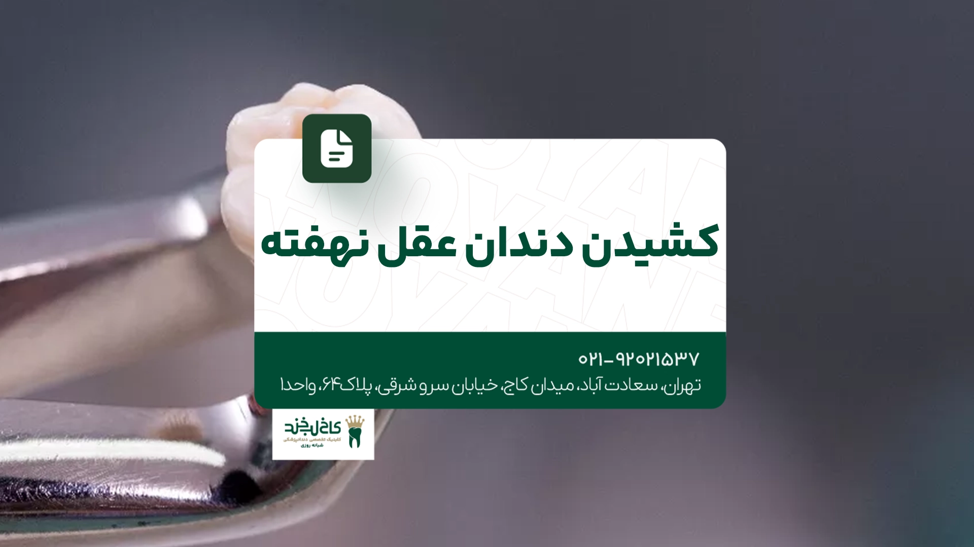 کشیدن دندان عقل نهفته