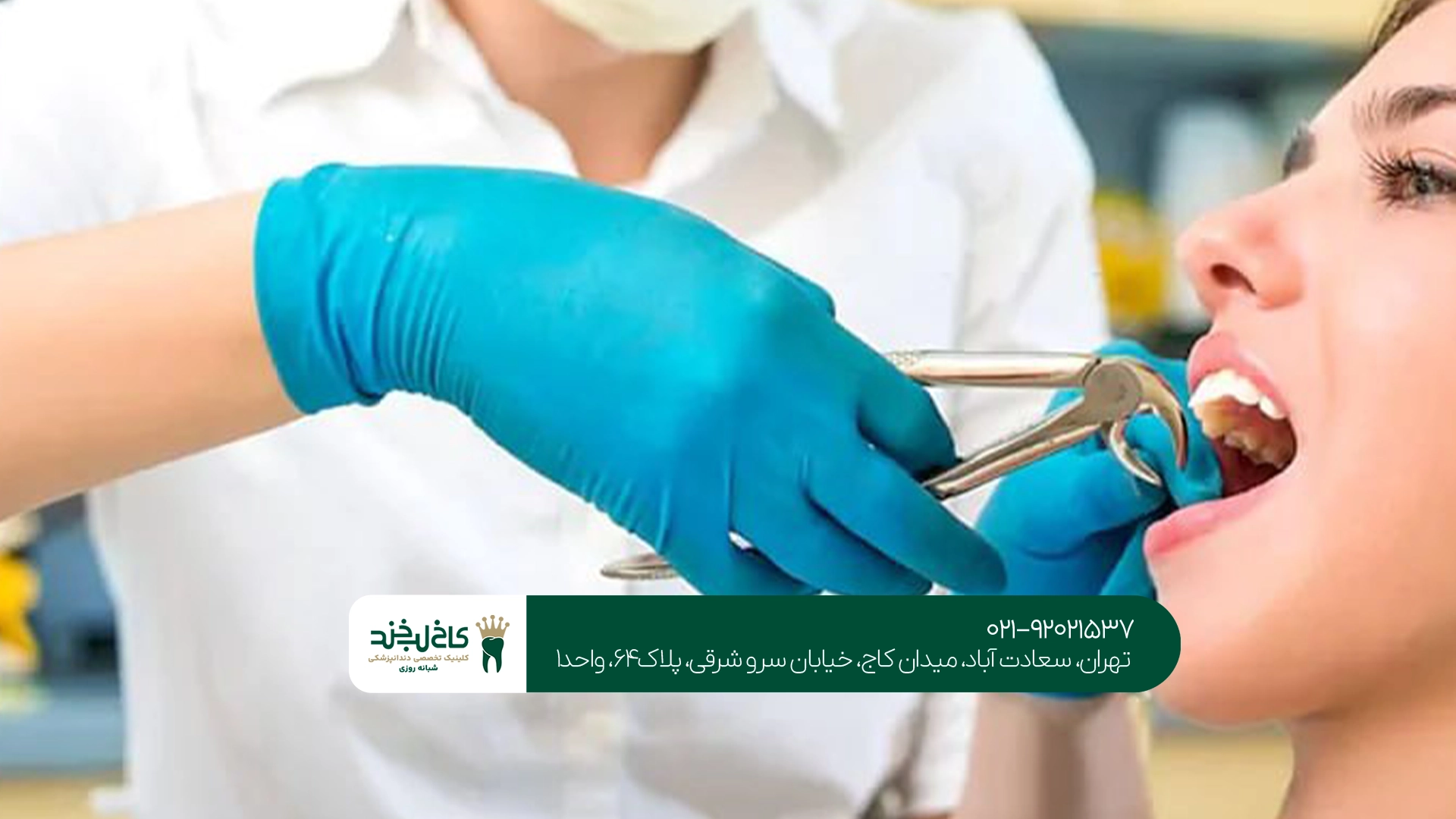 چه زمانی بعد از کشیدن دندان باید به دندانپزشک مراجعه کرد؟ چه زمانی بعد از کشیدن دندان باید به دندانپزشک مراجعه کرد؟