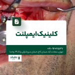 کلینیک ایمپلنت