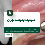 کلینیک ایمپلنت تهران
