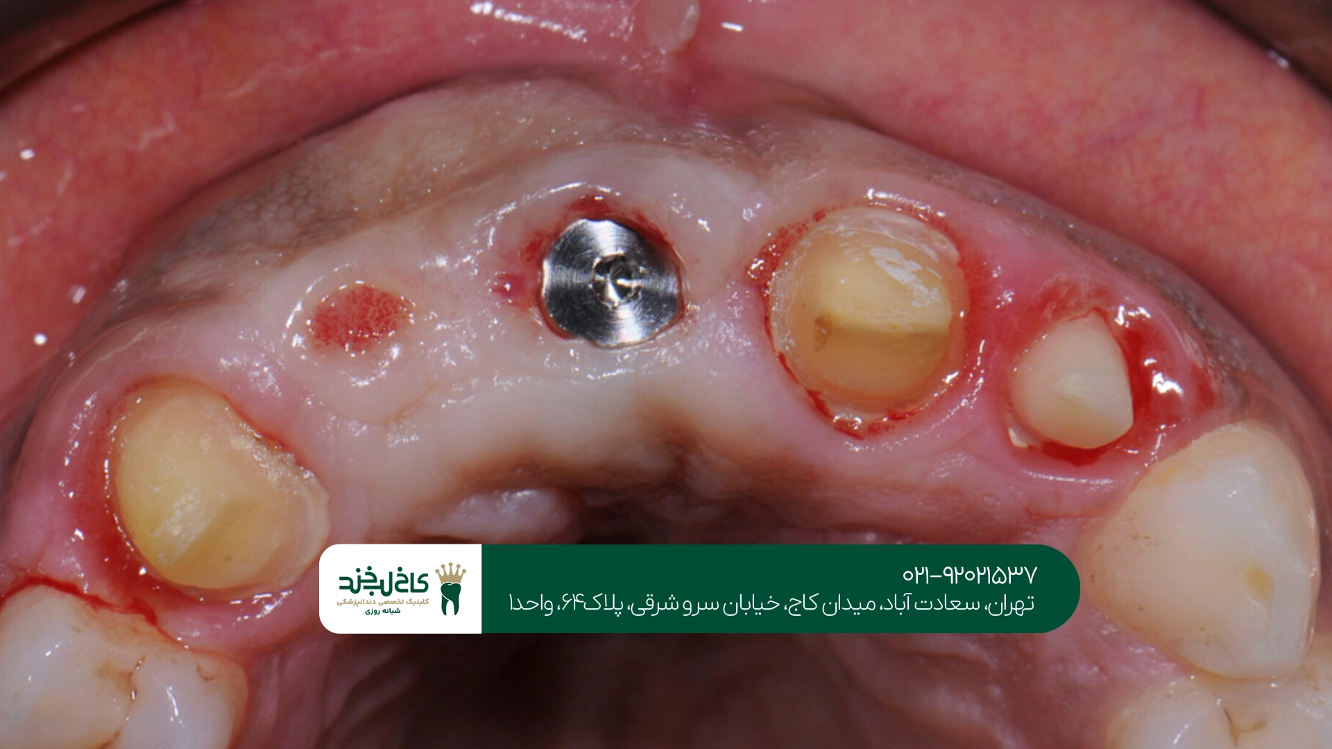 تجهیزات مورد نیاز در کلینیک تخصصی ایمپلنت تهران