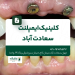 کلینیک ایمپلنت سعادت آباد