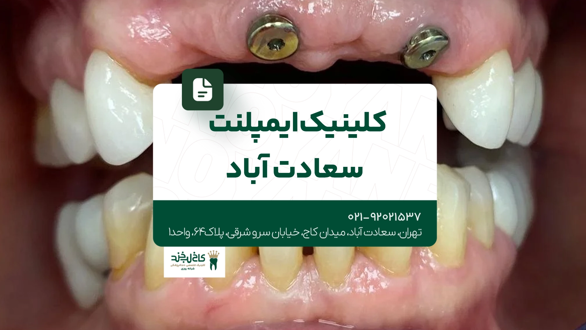 کلینیک ایمپلنت سعادت آباد کلینیک ایمپلنت سعادت آباد