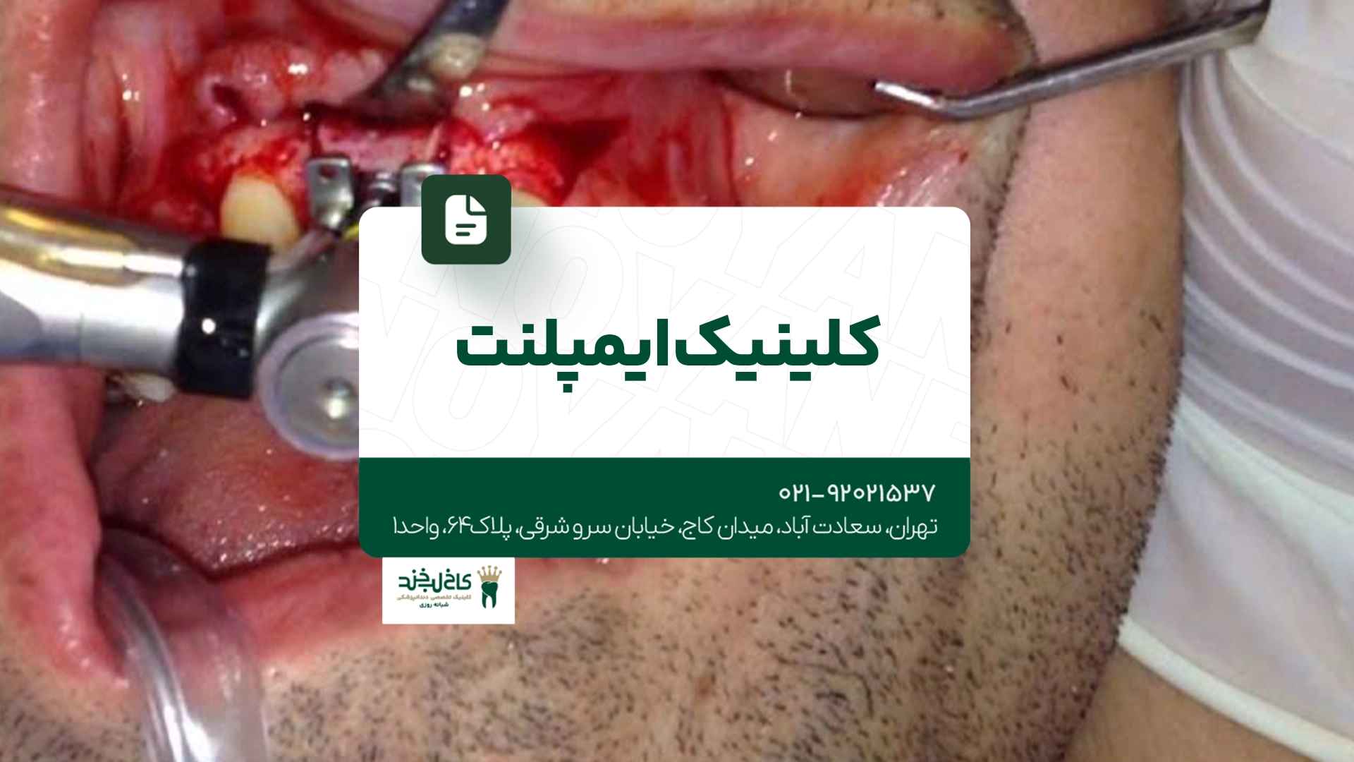 کلینیک ایمپلنت کلینیک ایمپلنت