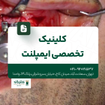 کلینیک تخصصی ایمپلنت