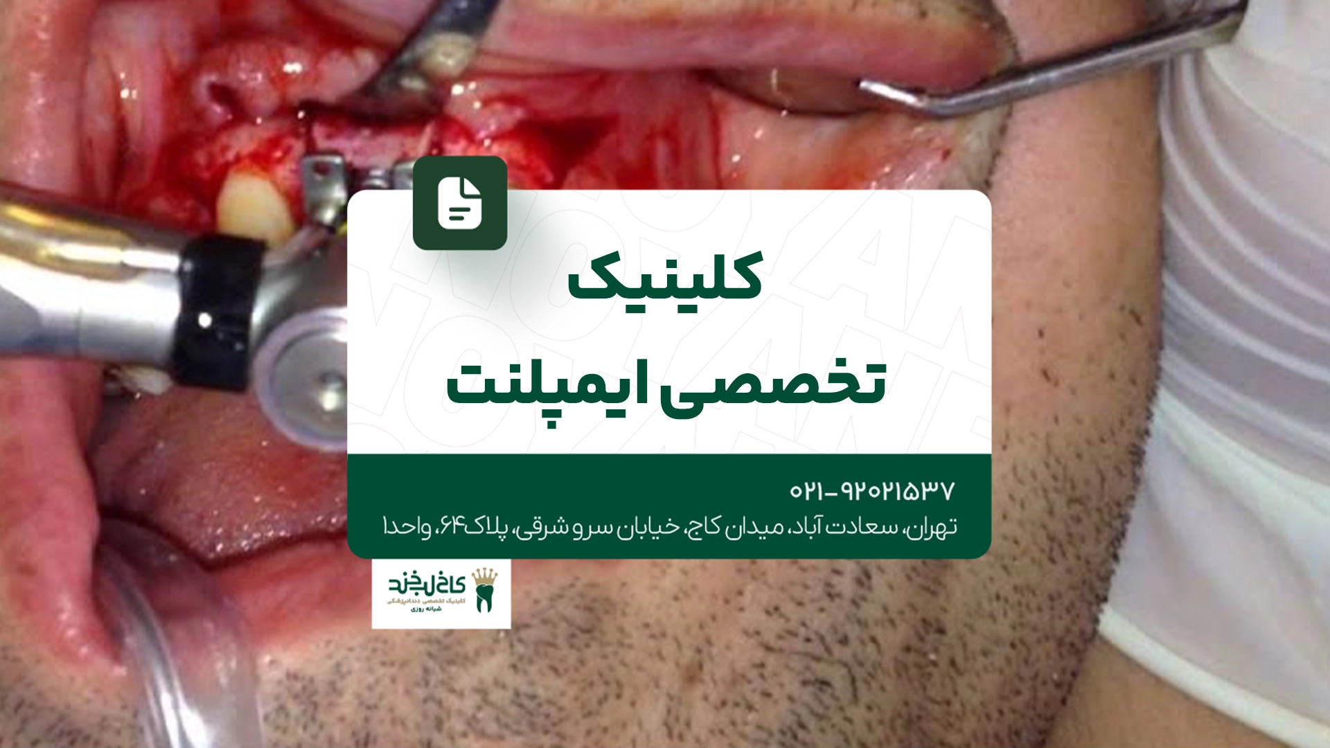کلینیک تخصصی ایمپلنت