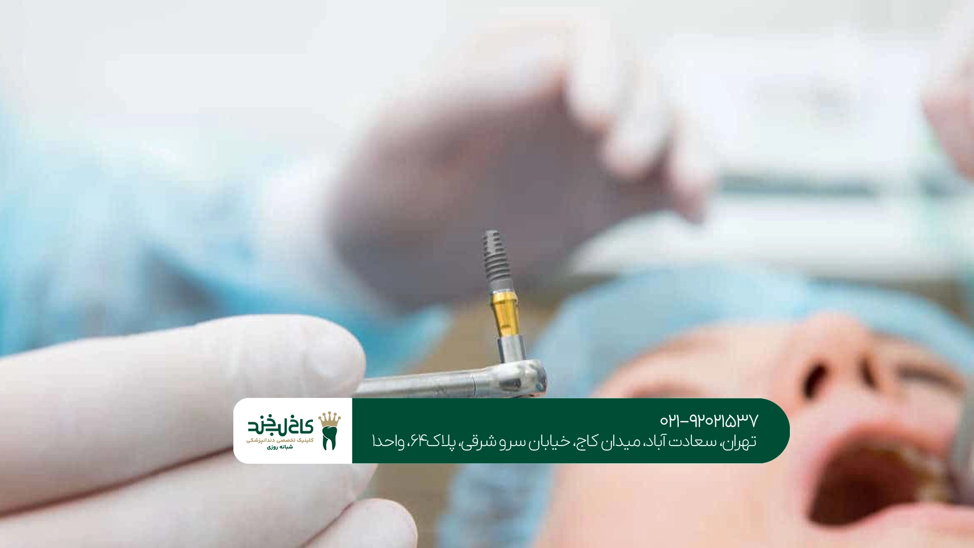 کلینیک تخصصی ایمپلنت در سعادت آباد