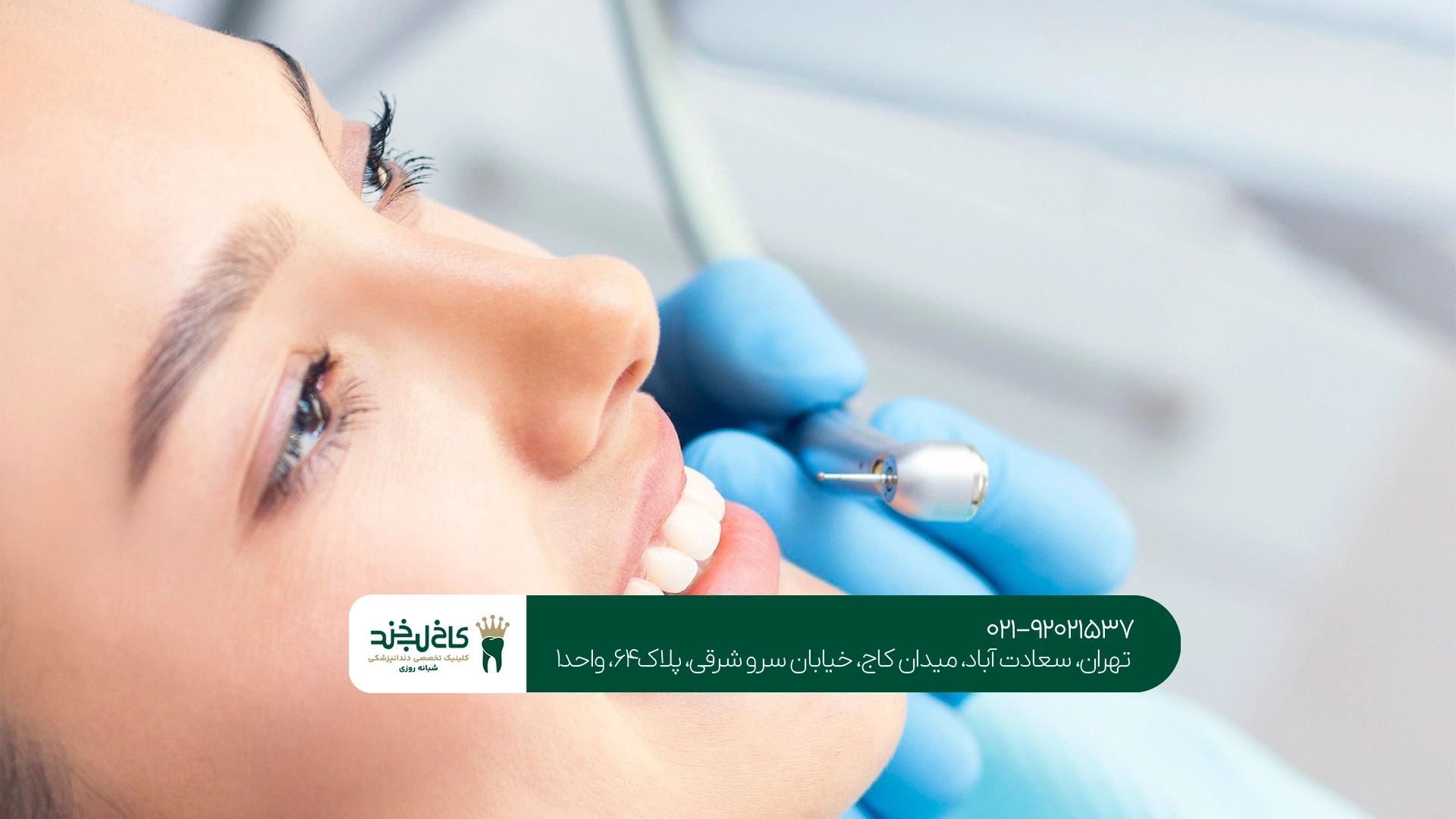 لمینت دندان برای چه کسانی مناسب است؟