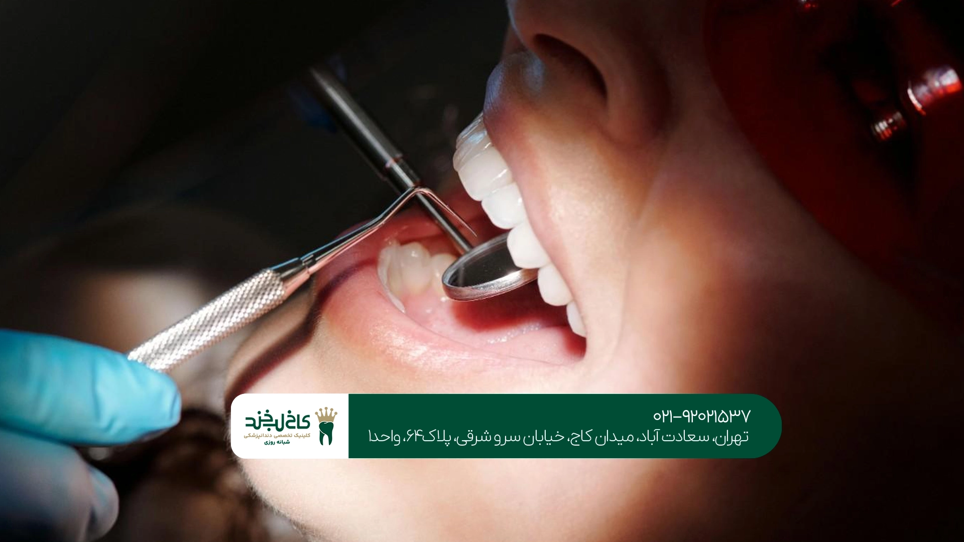 هزینه خدمات در کلینیک دندانپزشکی خوب تهران چقدر است؟