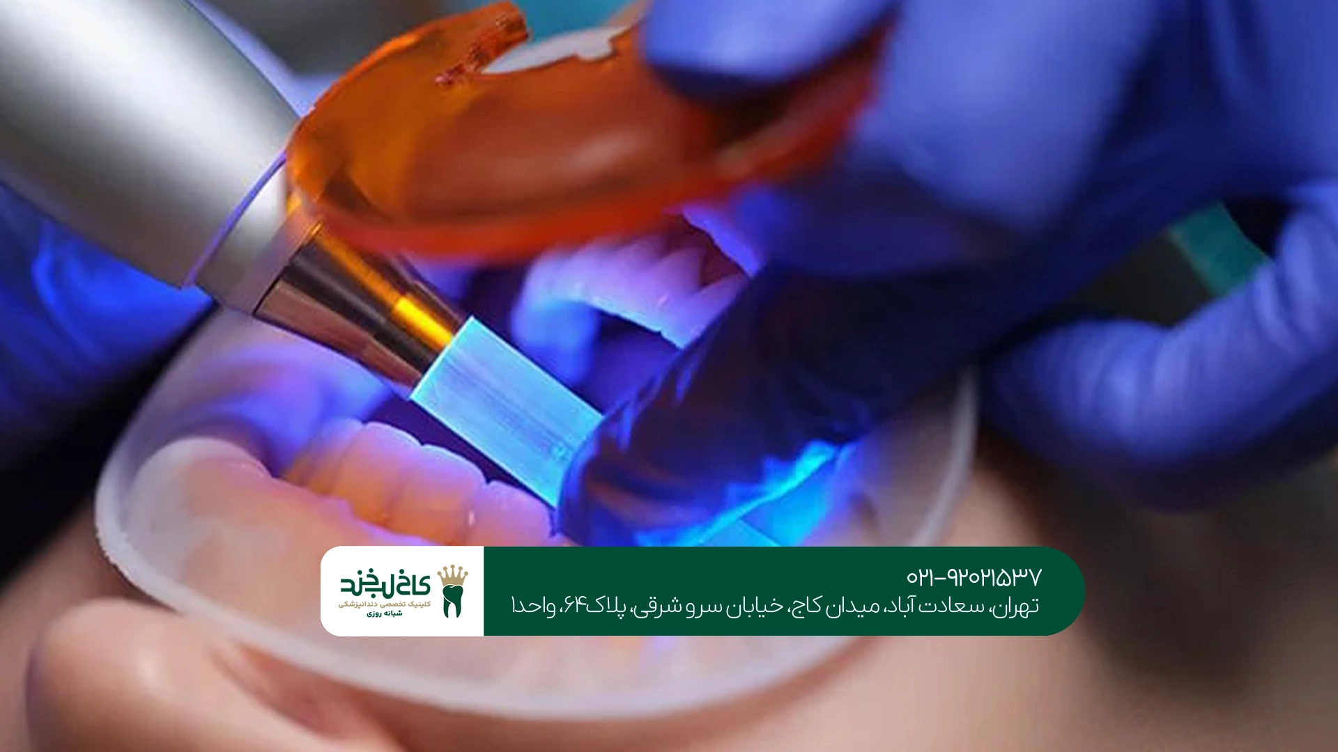 دندانپزشکی زیبایی شمال تهران