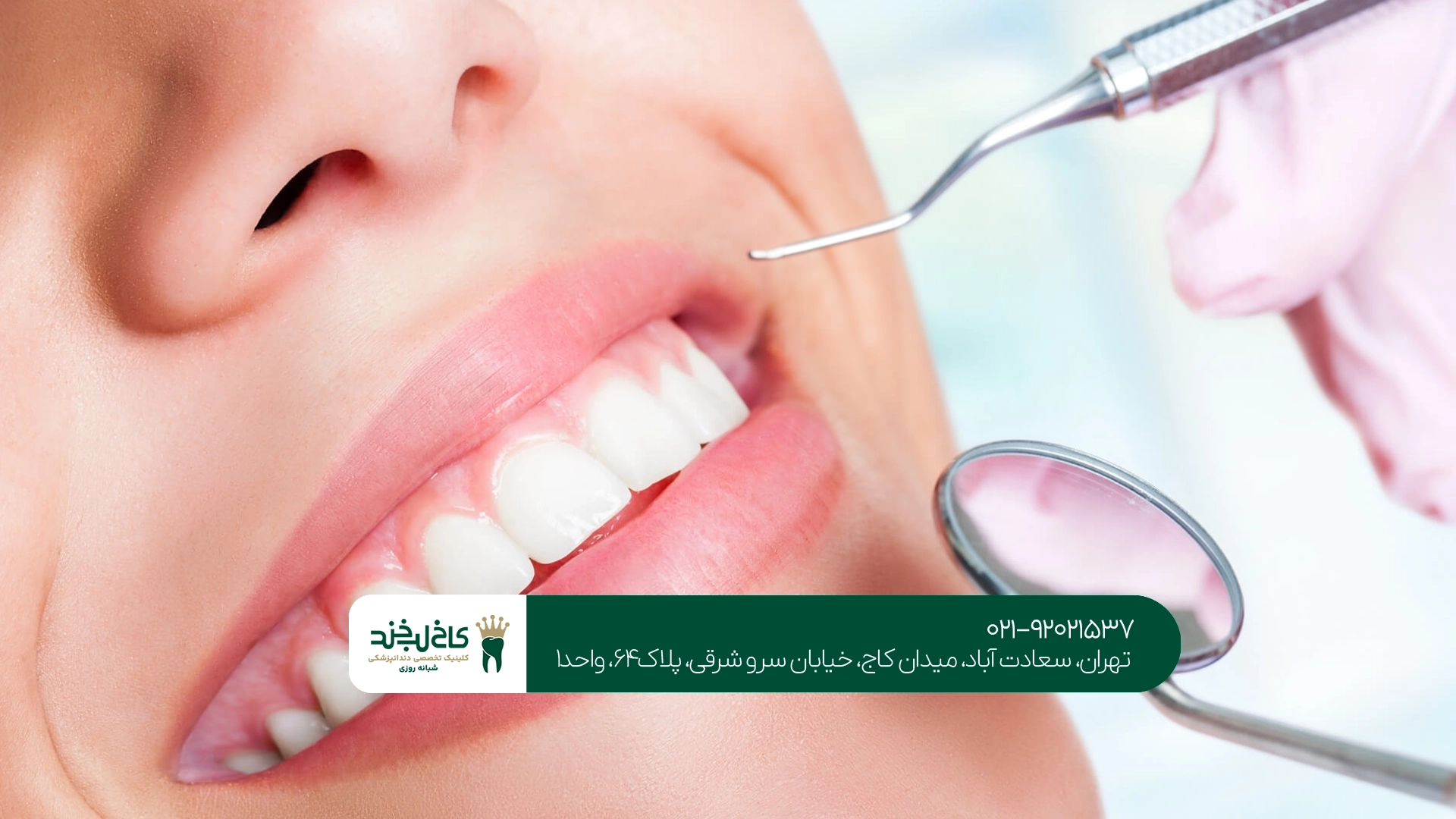 بهترین کلینیک زیبایی دندان تهران بهترین کلینیک زیبایی دندان تهران