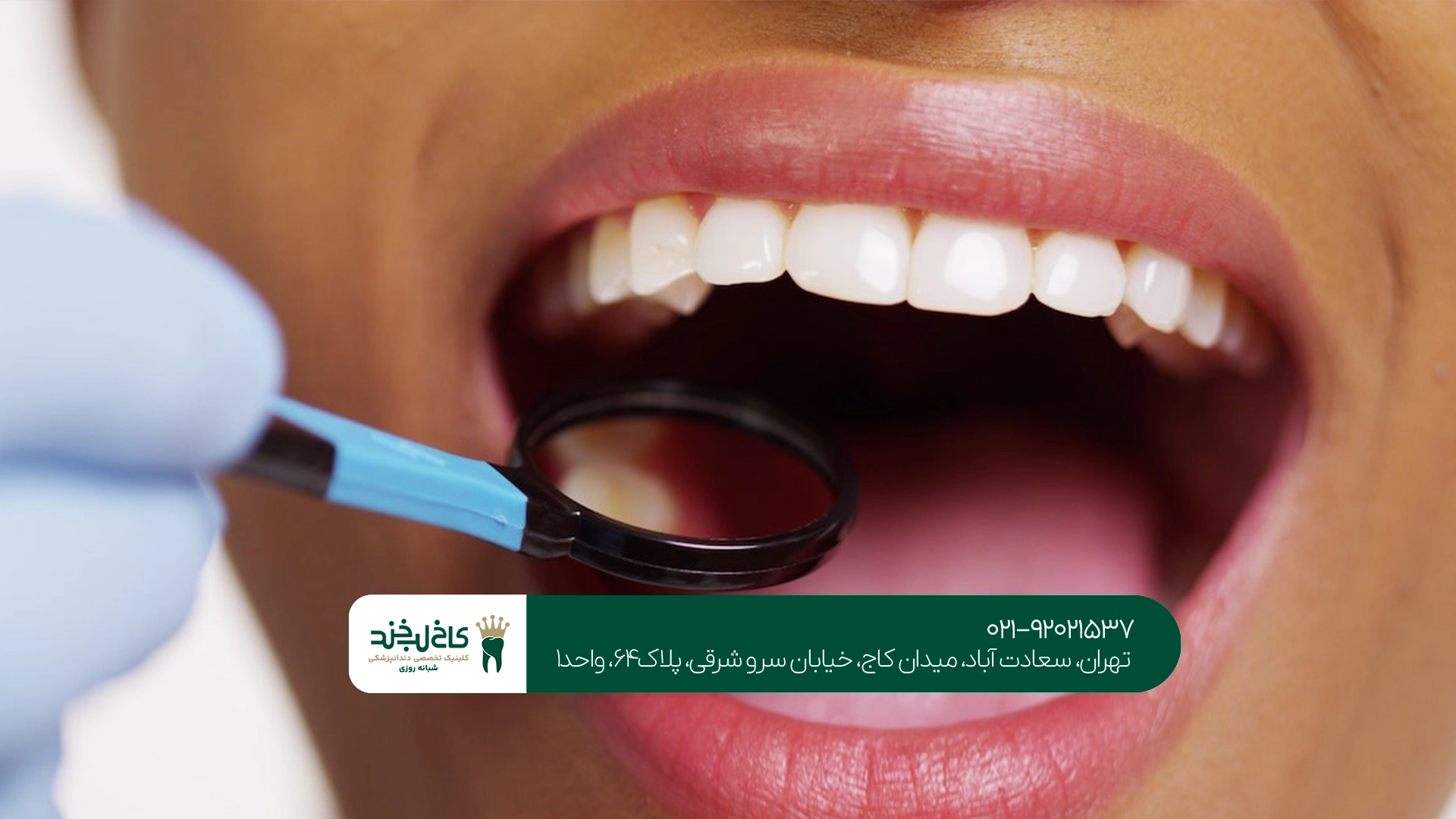 بهترین کلینیک زیبایی دندان تهران بهترین کلینیک زیبایی دندان تهران