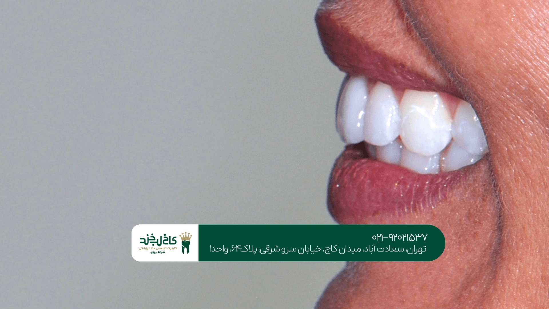 کلینیک زیبایی دندان با خدمات کامل
