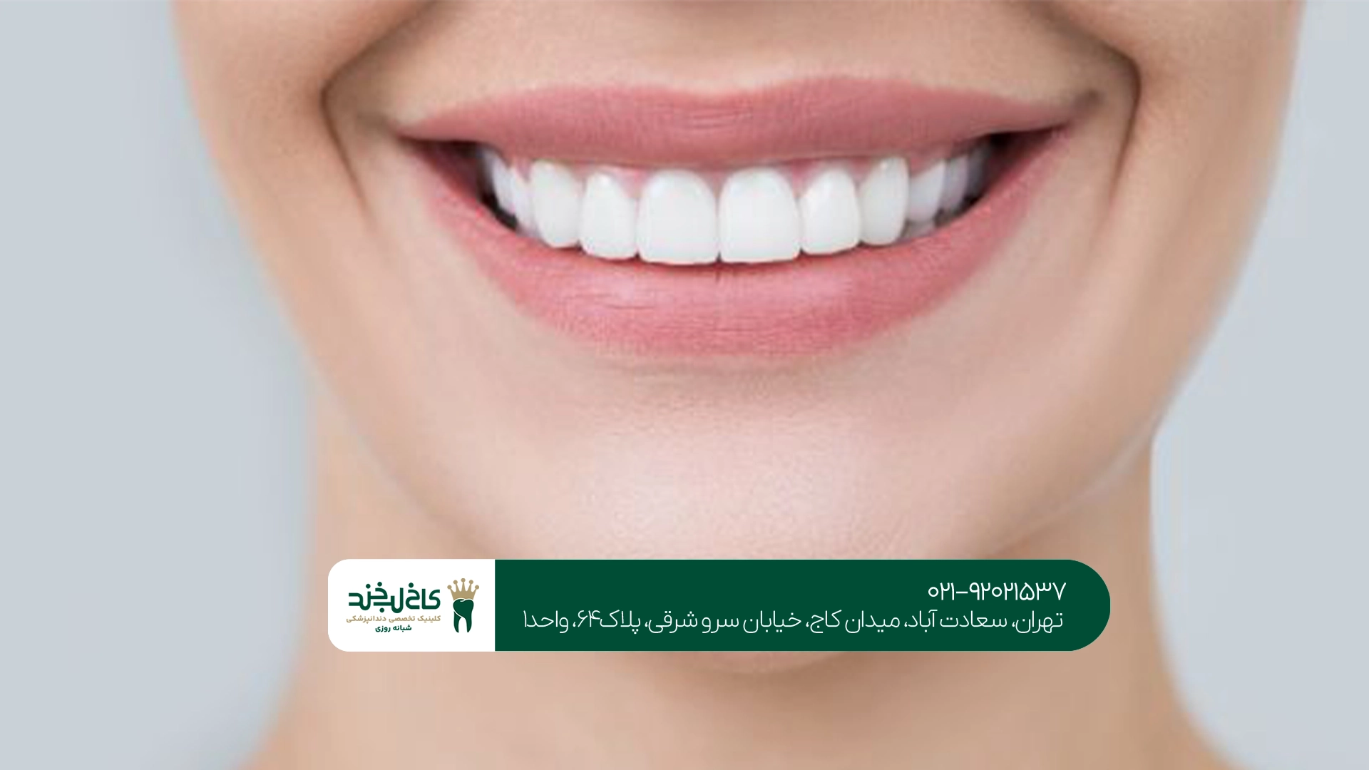 بهترین کلینیک زیبایی دندان در تهران کجاست؟