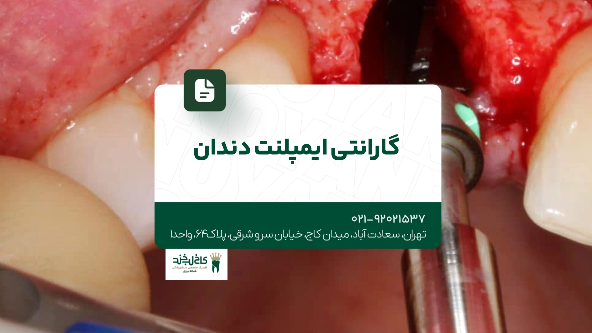 مرکز تخصصی کاشت دندان