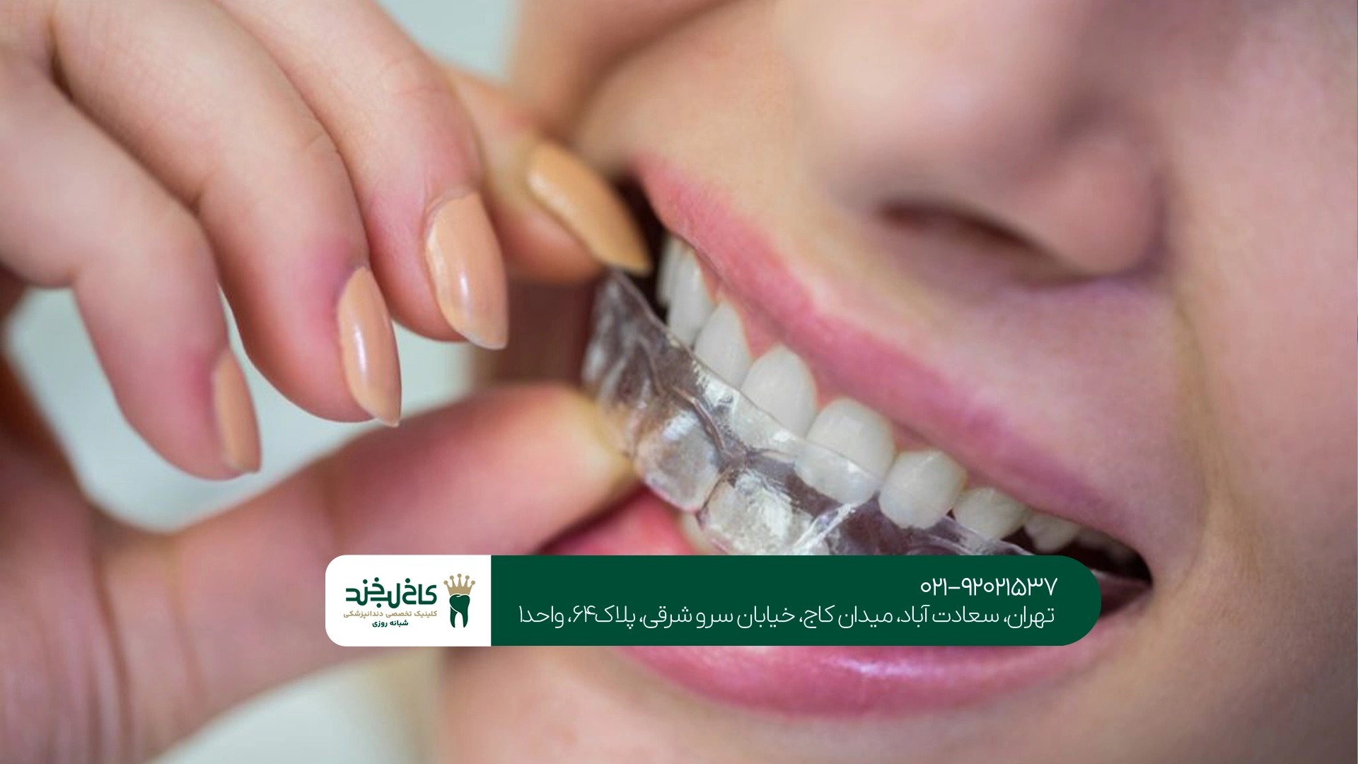 بهترین کلینیک الاینر در تهران بهترین کلینیک الاینر در تهران