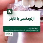 ارتودنسی با الاینر