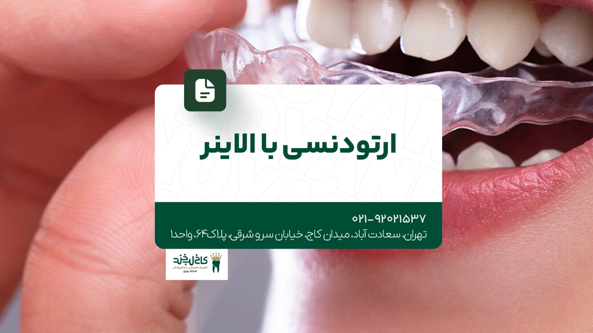 ارتودنسی با الاینر ارتودنسی با الاینر