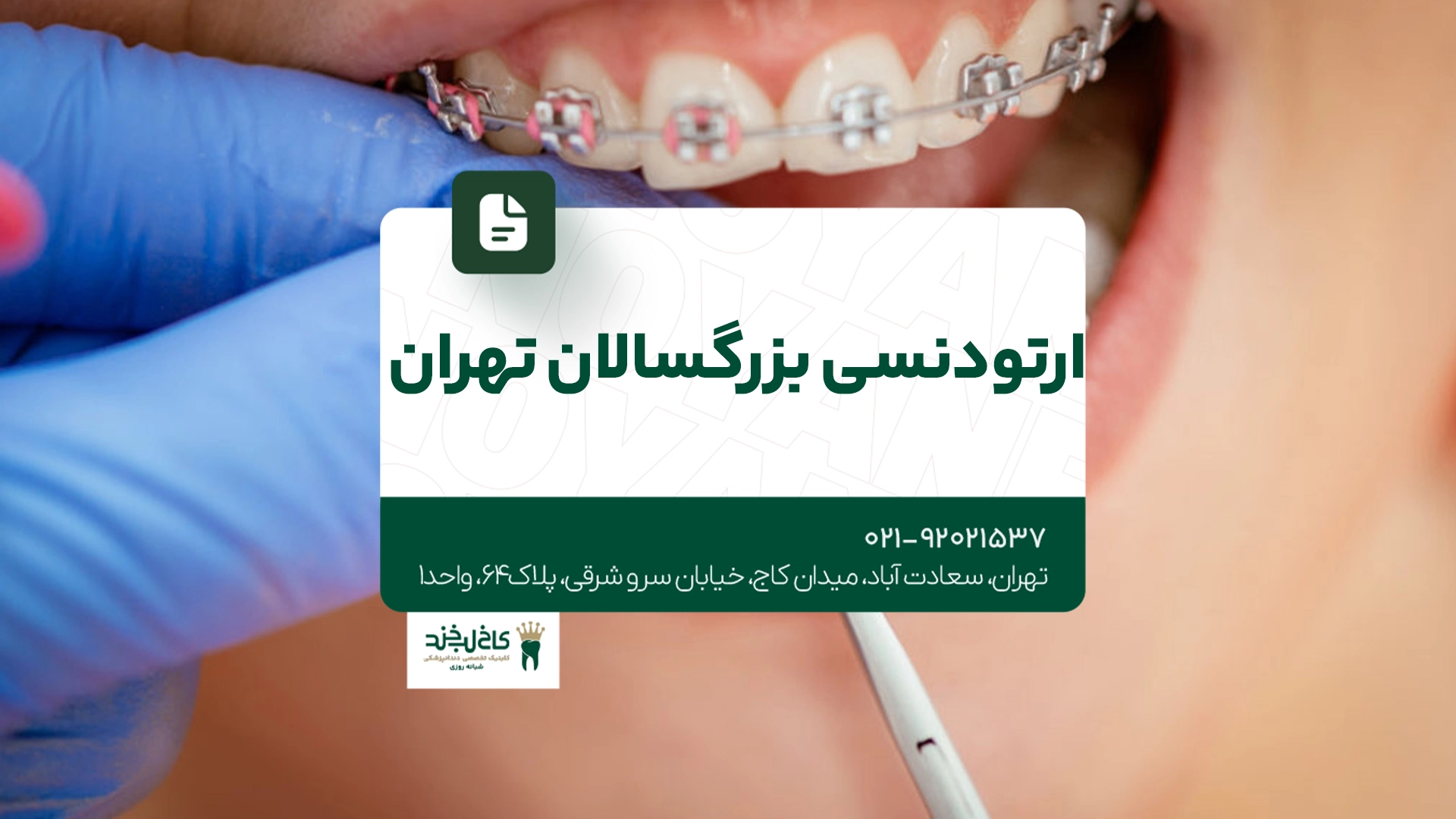 ارتودنسی بزرگسالان تهران