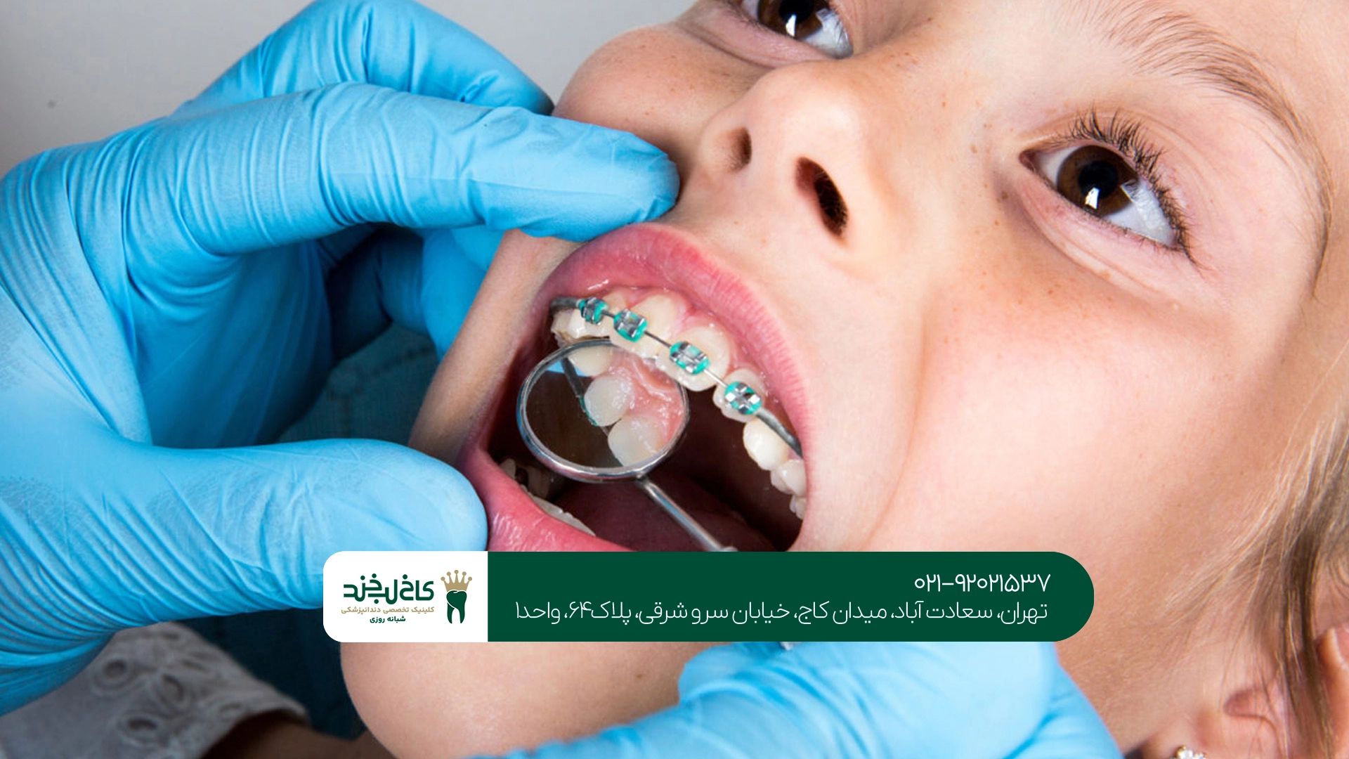ارتودنسی کودک با درمان تخصصی